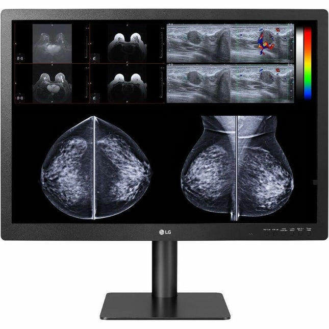 Main Image for Lenovo 78094614 31" Class 4K UHD LED Monitor - Black